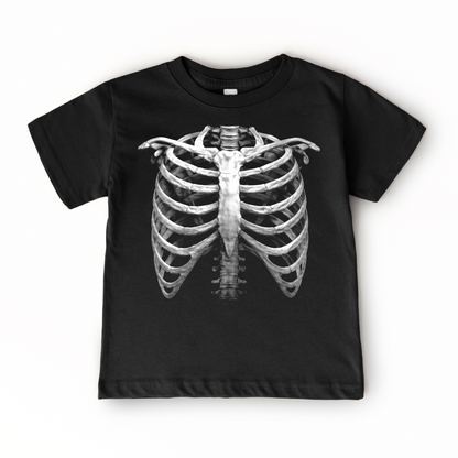 X-Ray